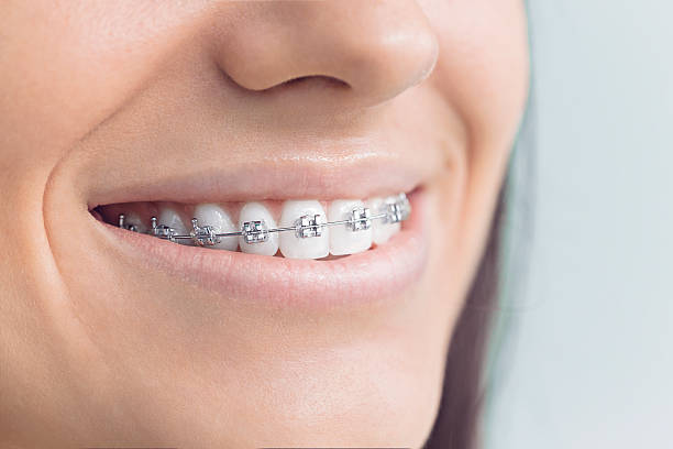 Best Veneers and Lumineers  in Bertville, AL